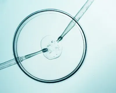 IVF Treatments: Trust and Technology for Your Dreams