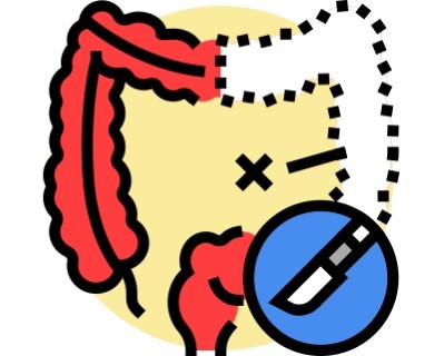 Bowel Resection