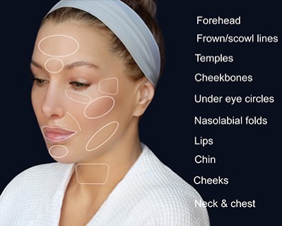 Dermal Fillers