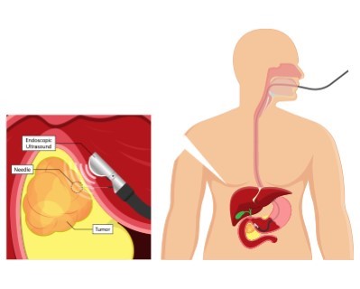 Treatmen image