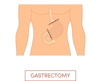 Treatmen image