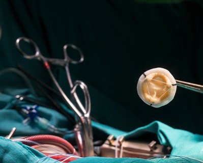 Heart Valve Replacement