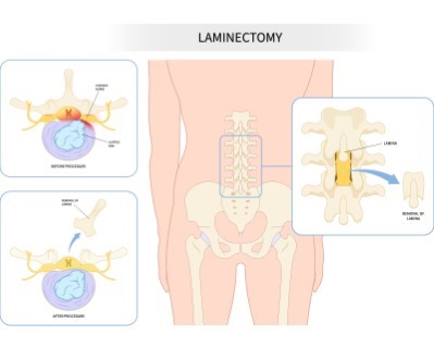 Treatmen image