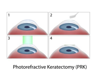 Treatmen image