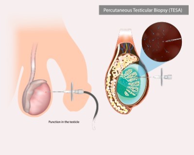 Treatmen image