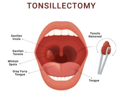 Treatmen image