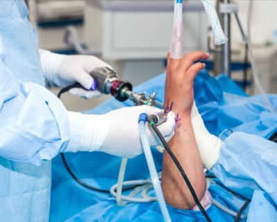 Wrist Arthroscopy